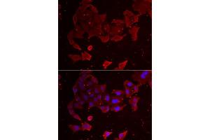 Immunofluorescence analysis of A549 cells using FLCN antibody (ABIN5973885). (FLCN Antikörper)