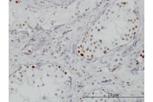 Immunoperoxidase of monoclonal antibody to BRD3 on formalin-fixed paraffin-embedded human testis. (BRD3 Antikörper  (AA 418-556))