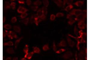 ABIN6274728 staining COLO205 by IF/ICC. (MRPL12 Antikörper  (Internal Region))