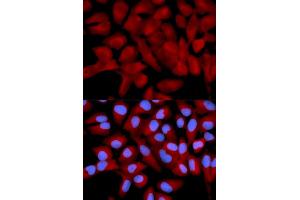 Immunofluorescence analysis of U2OS cells using EIF5A antibody (ABIN5971052).