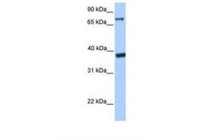 Image no. 1 for anti-Death Inducer-Obliterator 1 (DIDO1) (AA 480-529) antibody (ABIN6737879) (DIDO1 Antikörper  (AA 480-529))