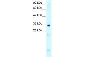 WB Suggested Anti-HOXB9 Antibody Titration:  0.