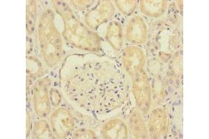 Immunohistochemistry of paraffin-embedded human kidney tissue using ABIN7168641 at dilution of 1:100 (SCFD1 Antikörper  (AA 373-642))