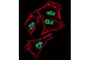 Fluorescent confocal image of A2058 cell stained with PROX1 Antibody .
