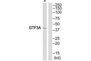 Western blot analysis of extracts from Jurkat cells, using GTF3A antibody.