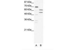 Image no. 1 for anti-Zinc Finger and BTB Domain Containing 43 (ZBTB43) (AA 151-200) antibody (ABIN202596) (ZBTB43 Antikörper  (AA 151-200))