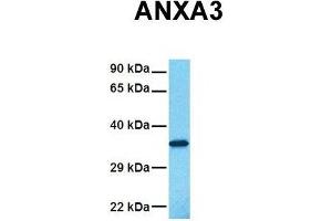 Host:  Rabbit  Target Name:  ANXA3  Sample Tissue:  Human Fetal Lung  Antibody Dilution:  1. (Annexin A3 Antikörper  (N-Term))