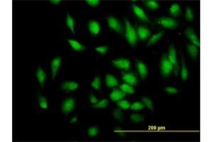 Immunofluorescence (IF) image for anti-phosphodiesterase 4D Interacting Protein (PDE4DIP) (AA 1-177) antibody (ABIN564175)