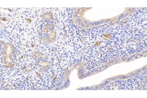 Immunohistochemistry (IHC) image for anti-Hemoglobin antibody (ABIN7429571)