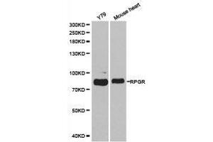 Western Blotting (WB) image for anti-Retinitis Pigmentosa GTPase Regulator (RPGR) antibody (ABIN1874639) (RPGR Antikörper)