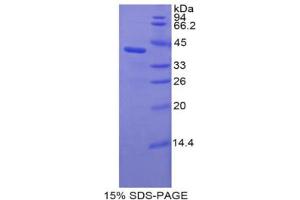 SDS-PAGE analysis of Rat C3a Protein.