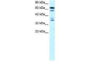 ZNF512 antibody used at 0. (ZNF512 Antikörper  (Middle Region))
