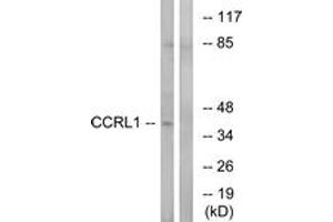 Western blot analysis of extracts from HepG2 cells, using CCRL1 Antibody. (CCRL1 Antikörper  (AA 291-340))