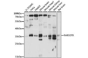 Western blot analysis of extracts of various cell lines, using RABGGTB antibody. (RABGGTB Antikörper)