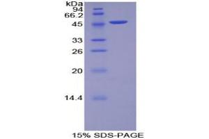 SDS-PAGE analysis of Rat MYL6B Protein. (MYL6B Protein)
