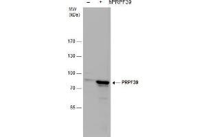 WB Image PRPF39 antibody detects PRPF39 protein by western blot analysis. (PRPF39 Antikörper)