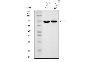 Western blot analysis of Glutaminase/GLS using anti-Glutaminase/GLS antibody (ABIN7601602).