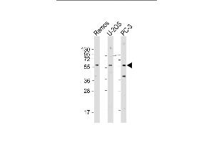 TRIM6 Antibody (N-term) (ABIN1881902 and ABIN2843419) western blot analysis in 293,A549,Ramos cell line lysates (35 μg/lane).
