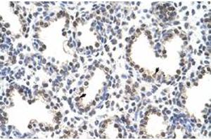 Immunohistochemical staining (Formalin-fixed paraffin-embedded sections) of human lung with FLJ12529 polyclonal antibody  at 4-8 ug/mL working concentration. (CPSF7 Antikörper  (C-Term))