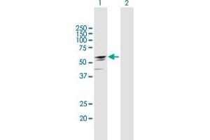 Western Blot analysis of EFHA2 expression in transfected 293T cell line by EFHA2 MaxPab polyclonal antibody. (EFHA2 Antikörper  (AA 1-530))