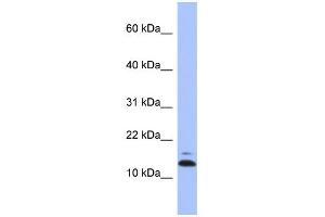 WB Suggested Anti-ASAH1 Antibody Titration: 0. (ASAH1 Antikörper  (N-Term))