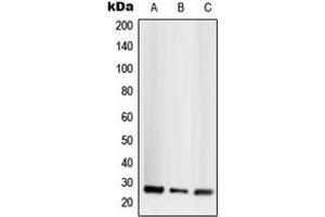 Western blot analysis of CD256 expression in HEK293T (A), SP2/0 (B), H9C2 (C) whole cell lysates. (TNFSF13 Antikörper  (Center))