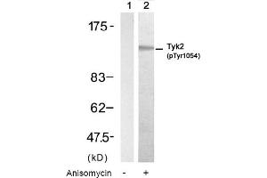 Image no. 1 for anti-Tyrosine Kinase 2 (TYK2) (pTyr1054) antibody (ABIN319229) (TYK2 Antikörper  (pTyr1054))