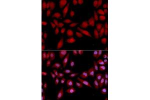 Immunofluorescence analysis of U2OS cells using PSMA2 antibody (ABIN5971338). (PSMA2 Antikörper)