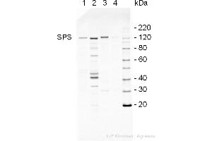 Western Blotting (WB) image for anti-SPS antibody (ABIN5706929) (SPS Antikörper)