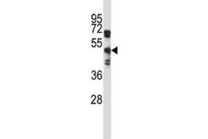 EDG8 antibody western blot analysis in A549 lysate. (S1PR5 Antikörper  (AA 219-247))