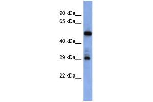 WB Suggested Anti-FOLR1 Antibody Titration:  0. (FOLR1 Antikörper  (Middle Region))