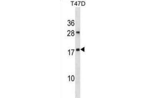 Western Blotting (WB) image for anti-ADP-Ribosylation Factor-Like 2 (ARL2) antibody (ABIN2998892) (ARL2 Antikörper)