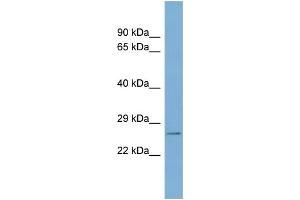 WB Suggested Anti-WBP2 Antibody Titration: 0. (WBP2 Antikörper  (N-Term))