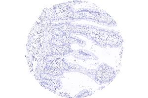 Ileum sample lacking MYH7 staining in all cells including smooth muscle