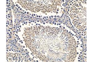 ABIN7094990 and ABIN7099046 at 1/100 staining rat testis tissue by IHC-P. (PRPS2 Antikörper)
