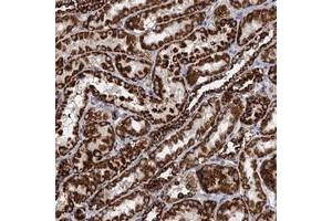 Immunohistochemical staining of human kidney with TIMM10 polyclonal antibody  shows strong cytoplasmic positivity in cells in tubules at 1:50-1:200 dilution. (TIMM10 Antikörper)