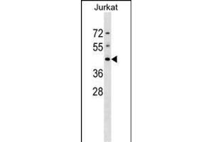DHPS Antibody (N-term) (ABIN1539082 and ABIN2848705) western blot analysis in Jurkat cell line lysates (35 μg/lane). (DHPS Antikörper  (N-Term))