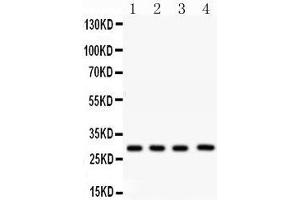 Western Blotting (WB) image for anti-Carbonic Anhydrase I (CA1) (AA 9-261) antibody (ABIN3043766) (CA1 Antikörper  (AA 9-261))