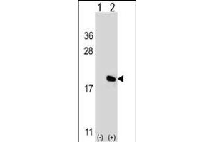 Western blot analysis of IL17A (arrow) using rabbit polyclonal IL17A Antibody (Center) (ABIN656842 and ABIN2846049). (Interleukin 17a Antikörper  (AA 61-87))
