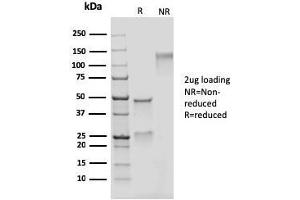SDS-PAGE Analysis Purified Adipophilin Recombinant Mouse Monoclonal Antibody (rADFP/1493). (Rekombinanter ADRP Antikörper  (AA 249-376))
