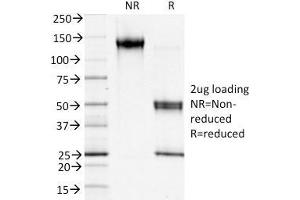 SDS-PAGE (SDS) image for anti-S100 Calcium Binding Protein A4 (S100A4) (AA 1-200) antibody (ABIN6940541)