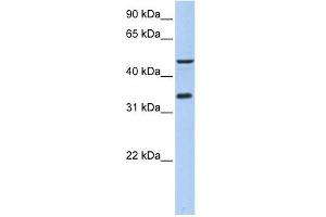 PIP3-E antibody used at 1 ug/ml to detect target protein. (ICEF1 Antikörper  (Middle Region))