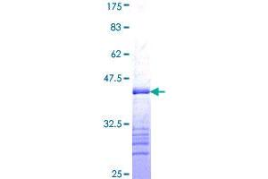 Progesterone Receptor Protein (PGR) (AA 1-110) (GST tag)