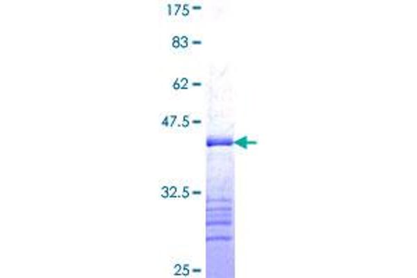 Progesterone Receptor Protein (PGR) (AA 1-110) (GST tag)