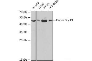 Western blot analysis of extracts of various cell lines using Factor IX / F9 Polyclonal Antibody at dilution of 1:1000. (Coagulation Factor IX Antikörper)