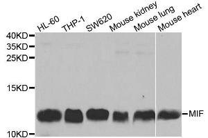Western blot analysis of extracts of various cell lines, using MIF antibody. (MIF Antikörper  (AA 1-115))
