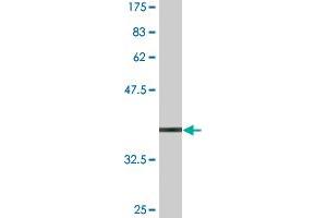 Western Blot detection against Immunogen (37. (IKZF4 Antikörper  (AA 2-108))