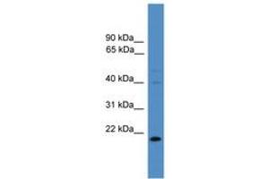 Image no. 1 for anti-TIMP Metallopeptidase Inhibitor 3 (TIMP3) (N-Term) antibody (ABIN6745331) (TIMP3 Antikörper  (N-Term))