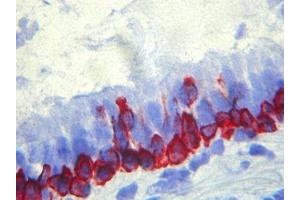 Immunohistochemistry (IHC) image for anti-Basal Membrane antibody (ABIN781795) (Basal Membrane Antikörper)