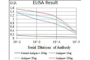 Black line: Control Antigen (100 ng), Purple line: Antigen(10 ng), Blue line: Antigen (50 ng), Red line: Antigen (100 ng), (Intestinal Alkaline Phosphatase Antikörper  (AA 397-458))